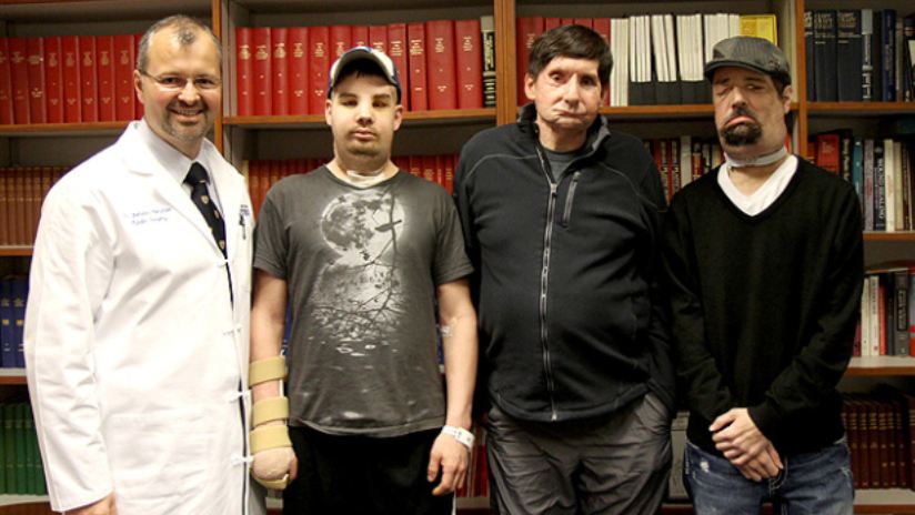 【醫療生科】｢變臉｣？從最新案例談臉部移植