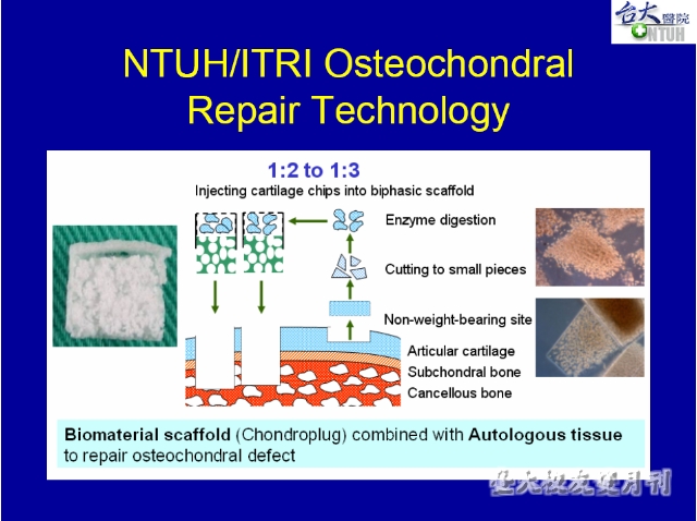 Biphasic Osteochondral Repair