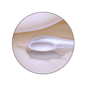 台美修補軟骨新科技，歐登林書豪你我皆受益