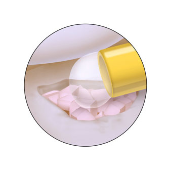 台美修補軟骨新科技，歐登林書豪你我皆受益