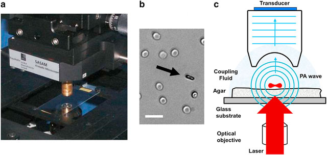 次世代超音波，一滴血找出病源
