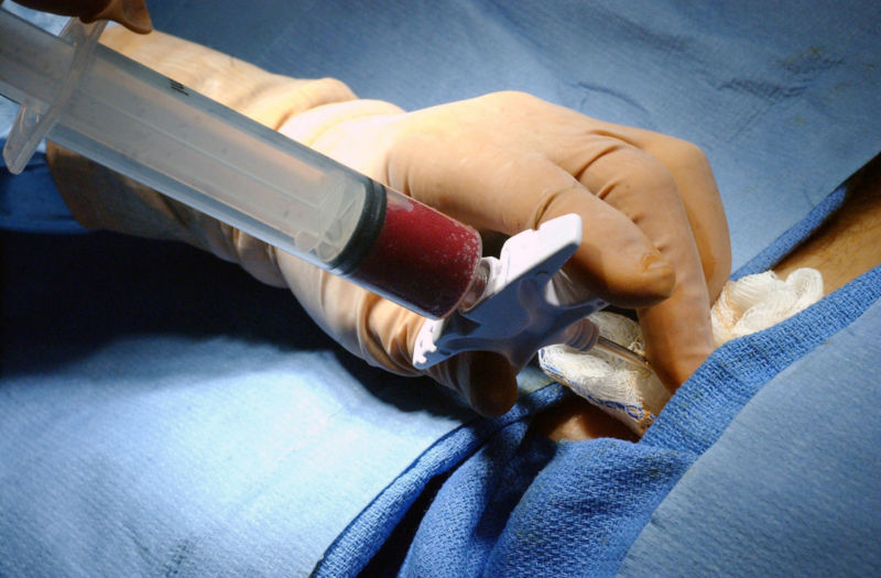Bone_marrow_stem_cell