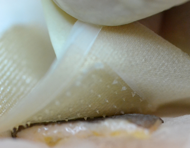 測試結核菌素：免打針，貼布就搞定