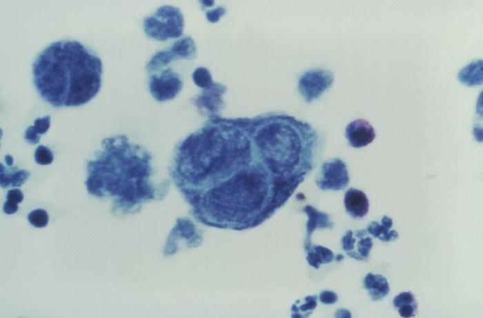 cytomegalovirus