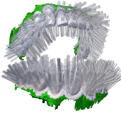 3d printing toothbrush