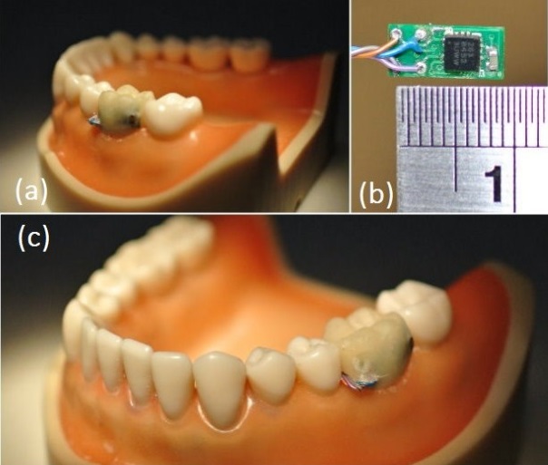 Teeth Probe ISWC
