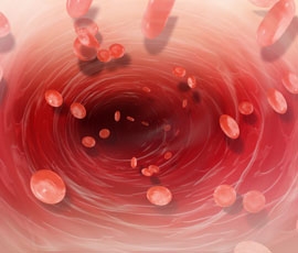 Coronary Artery Disease