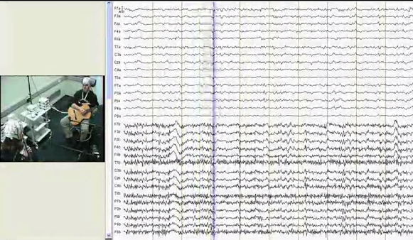 醫界可望發展 ADHD 精確診斷法 老藥也可新用