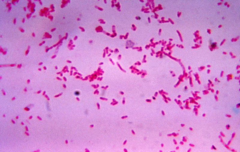 Fusobacterium_novum_ 梭桿菌