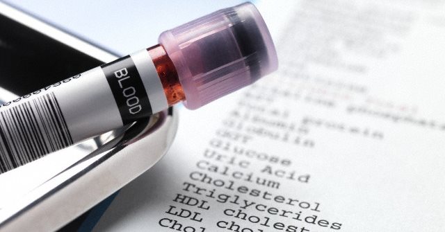 Blood Testing with Results