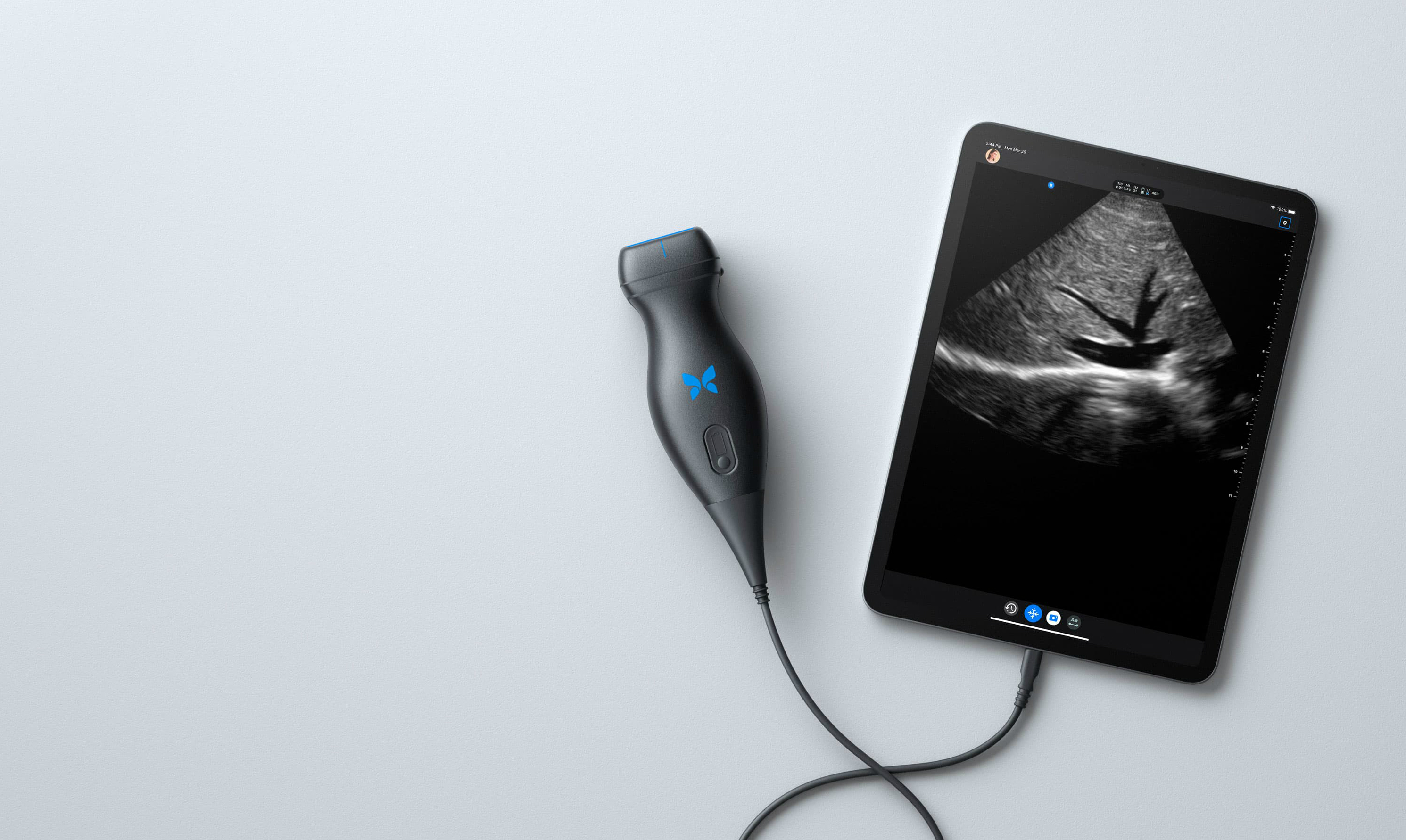 超音波検査の後