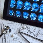 人口變化與政策支持將加速中國醫療 AI 產業發展