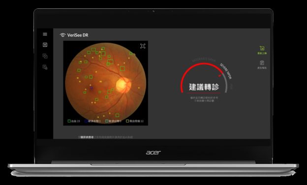 宏碁智醫擴大東南亞布局，AI 醫材插旗菲律賓