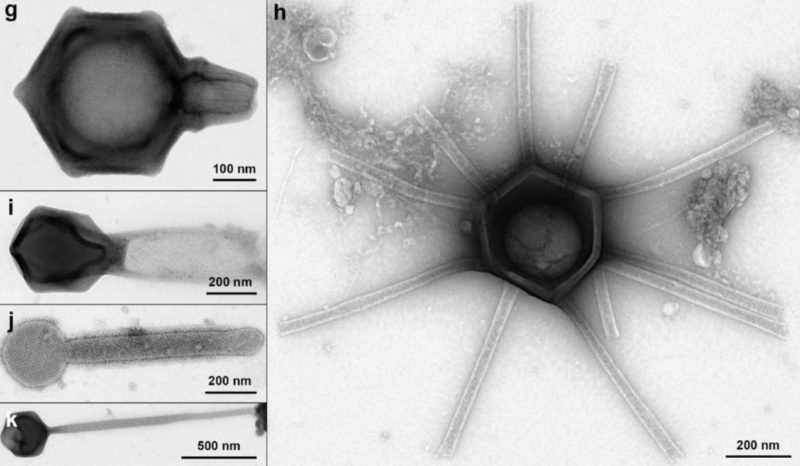 森林發現一系列巨型病毒，科學家：看起來有手有腳