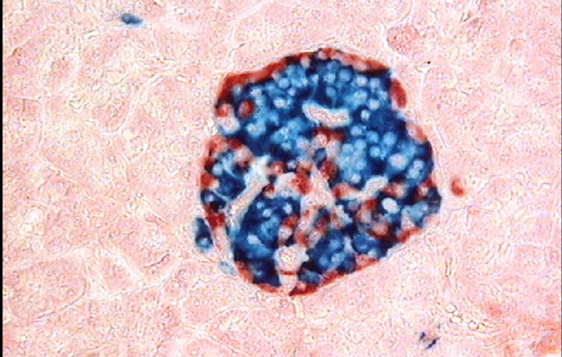 糖尿病治療發現再進一步，聯合療法確認可提高療效 700 倍