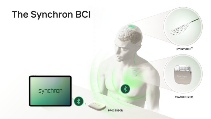 蘋果攜手 Synchron 打造意念操控技術，讓身障者用腦操作裝置