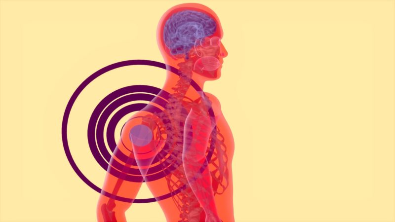 刺激迷走神經：治療類風濕性關節炎的新方向