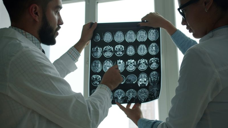 醫學影像界的 ChatGPT，AI 系統 Prima 以 97.5% 準確率秒讀腦部 MRI