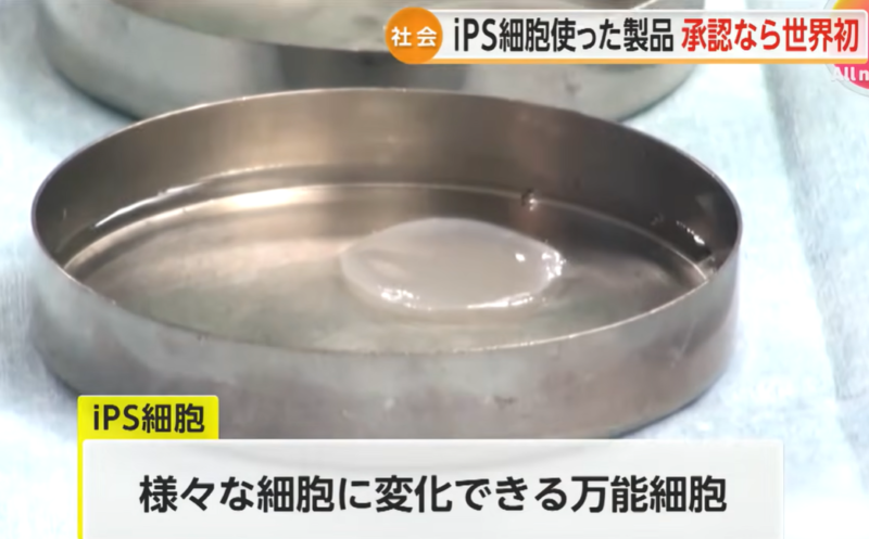 日本批准兩項 iPS 細胞再生醫療產品，創全球首例
