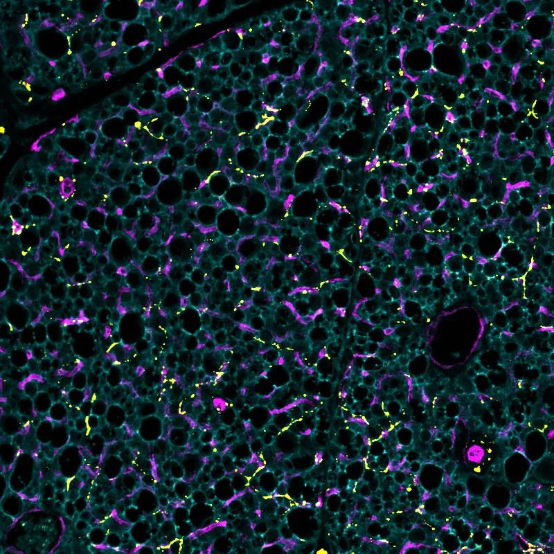 科學家發現關鍵蛋白質，有望將棕色脂肪變成「燃脂引擎」